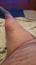 otelmo — Cam4 stream photo (Feb 2026)