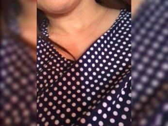 TenderBerry — Bongacams stream photo (Jun 2026)